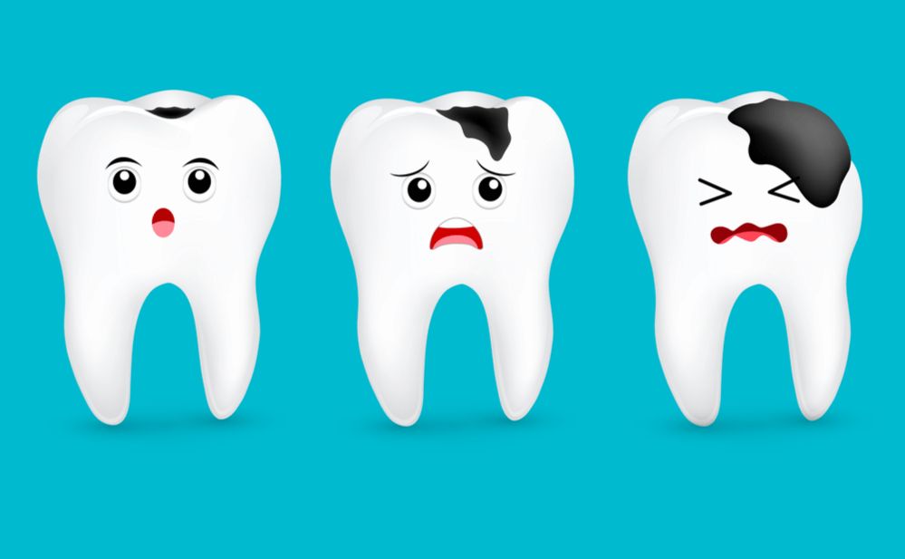 Descuidar tu boca - caries