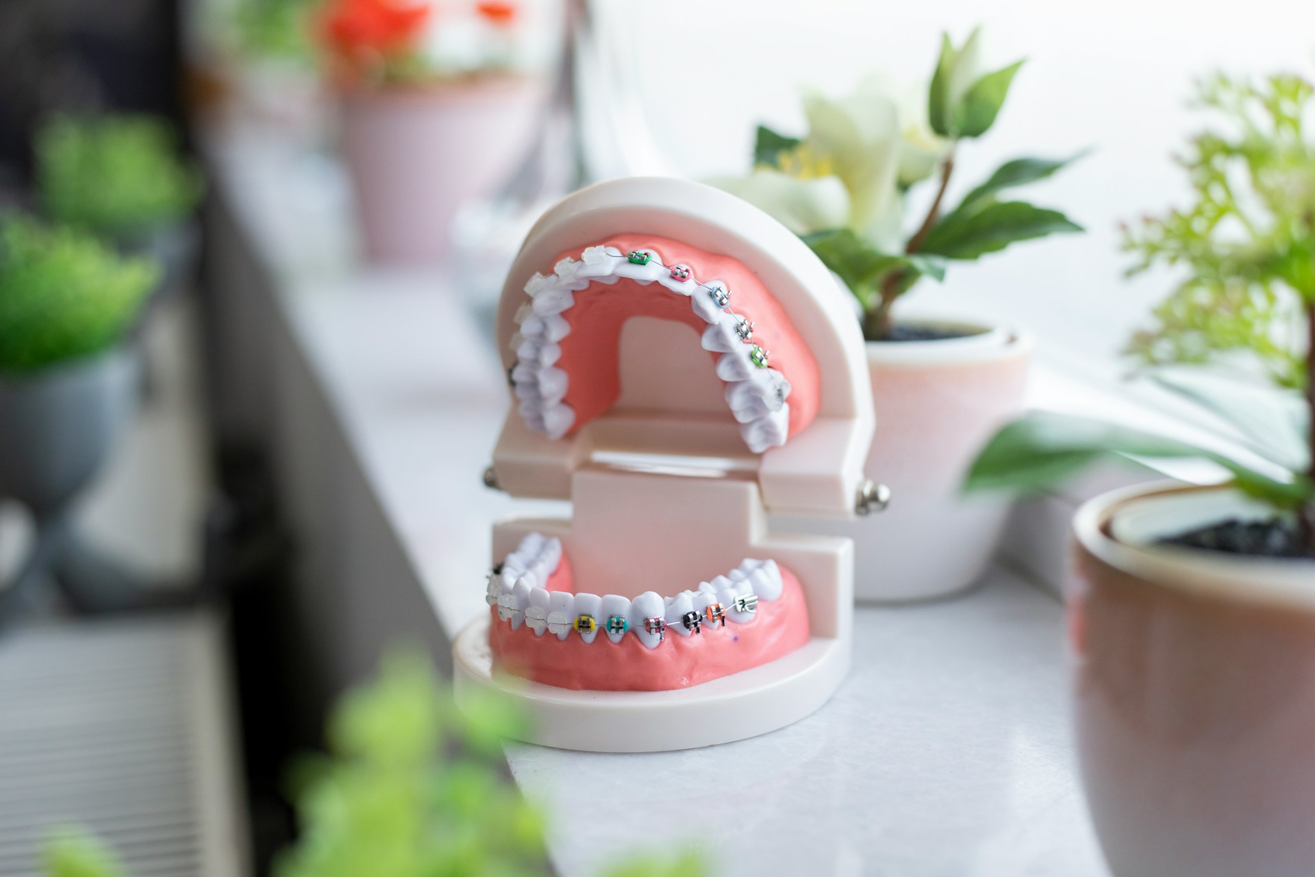Ortodoncia - SmileClinic - Alfaz del Pi