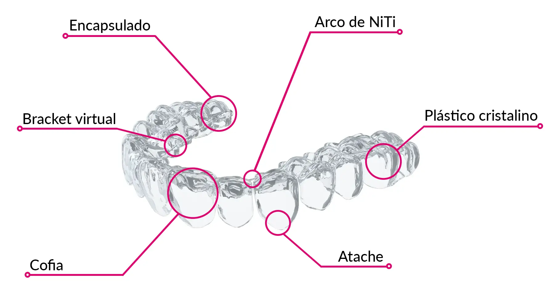 Descripcion - ortodoncia invisible - SmileClinic - Geniova - Alfaz del Pi