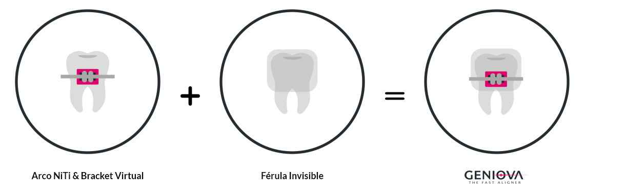 ortodoncia invisible - funcionamiento - SmileClinic - Geniova - Alfaz del Pi
