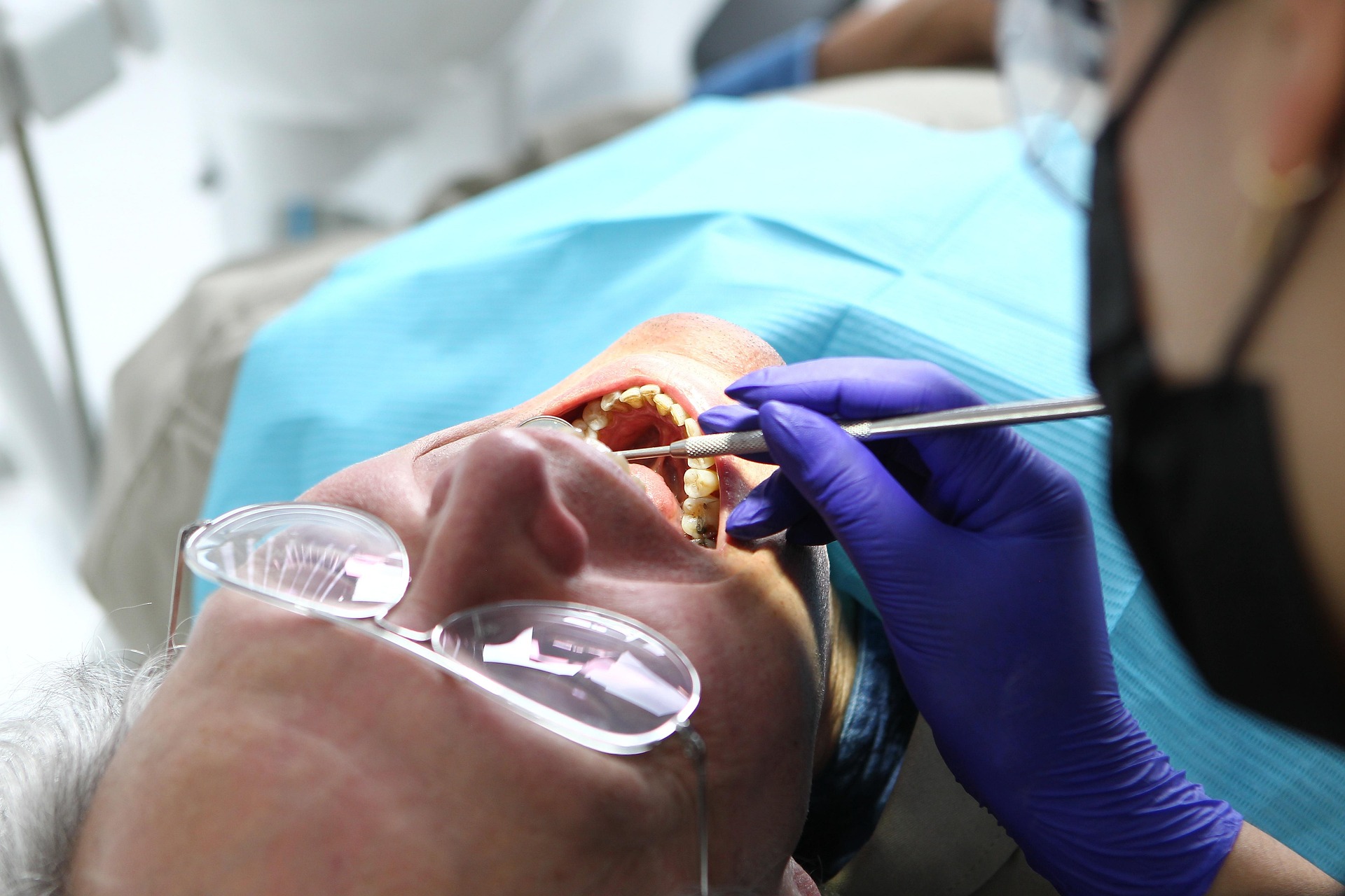 limpieza dental profesiona