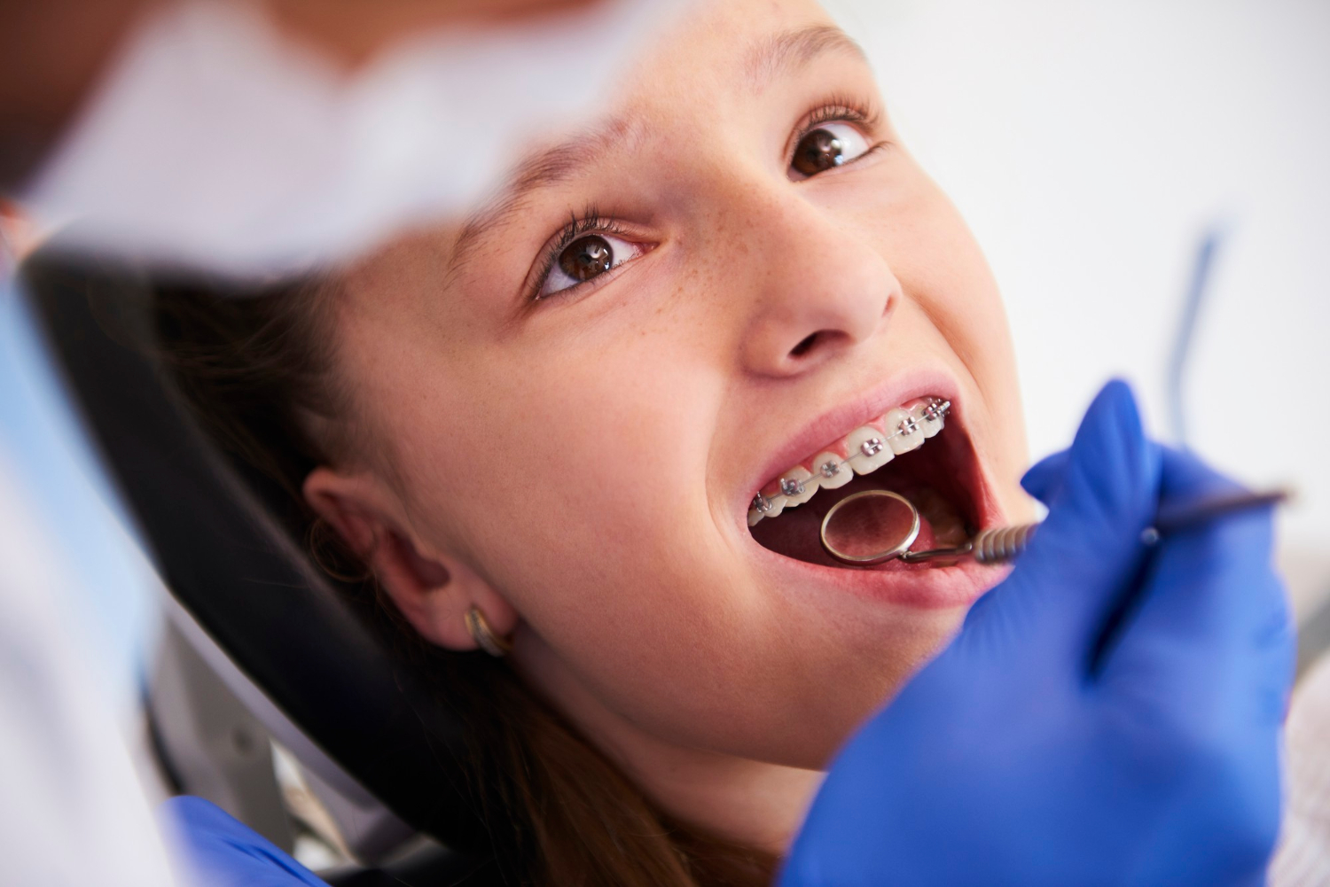 Ortodoncia tradicional - SmileClinic
