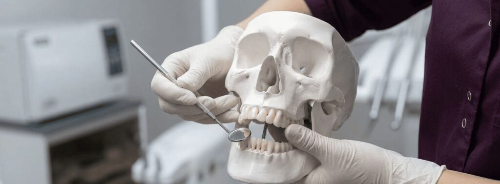 Anquilosis Dental en Alfaz del PI