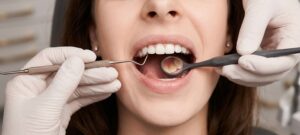 Erosión ácida dental en Alfaz del Pi