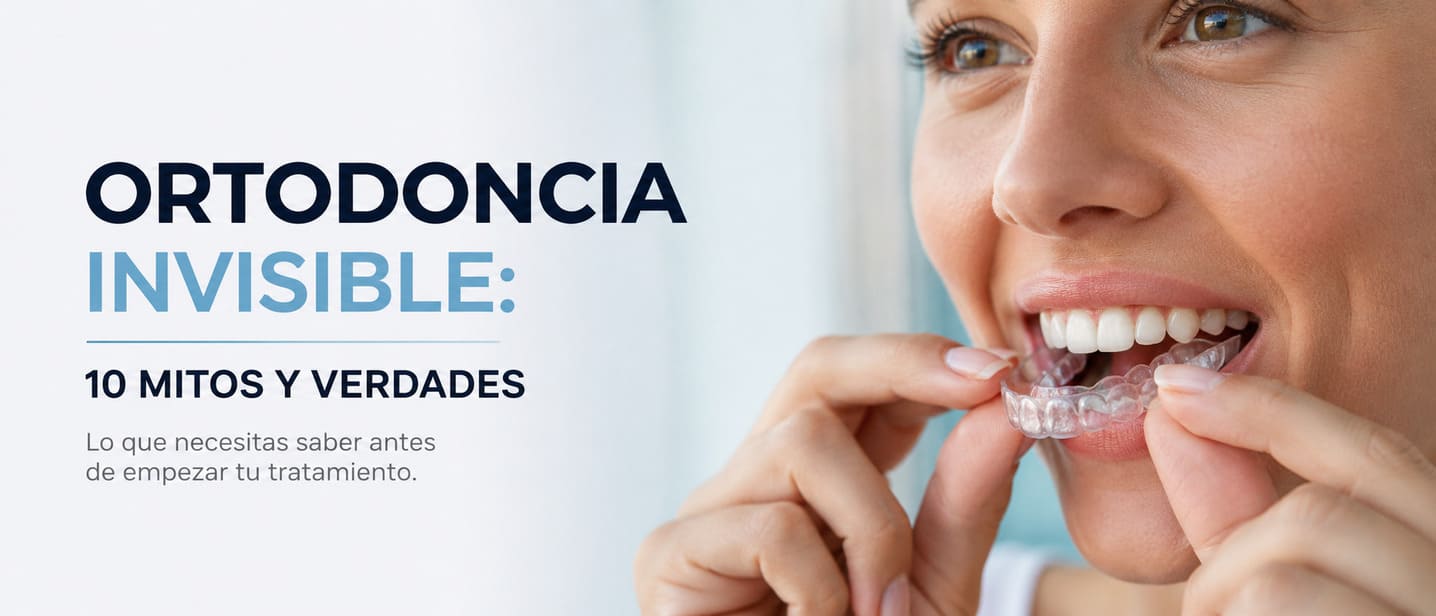 Top 10 mitos y verdades sobre la ortodoncia invisible - SmileClinic Alfaz del Pi