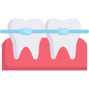 ortodoncia en Alfaz del Pi - Smile Clinic